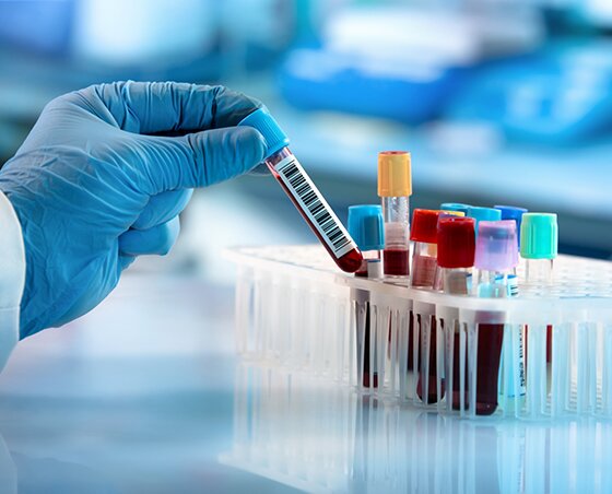 Avanta, Centru medical analize